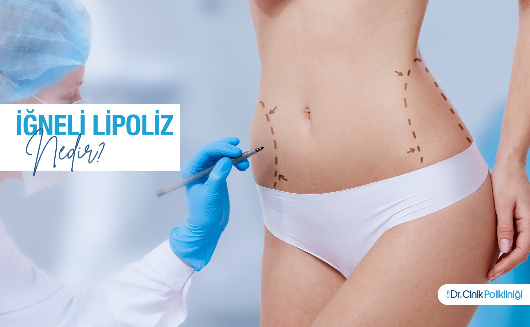 What is Needle Lipolysis and why has it gained such importance in Aesthetic Medicine?