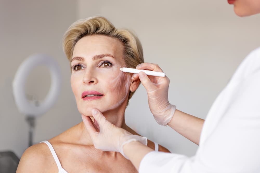Vampir Facelift Nedir?