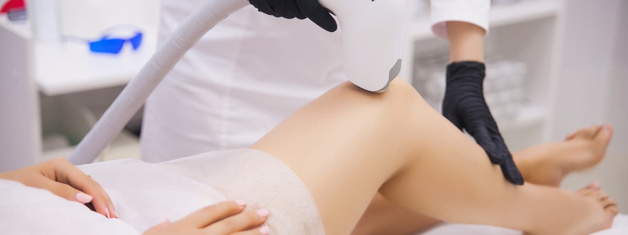 Epilation