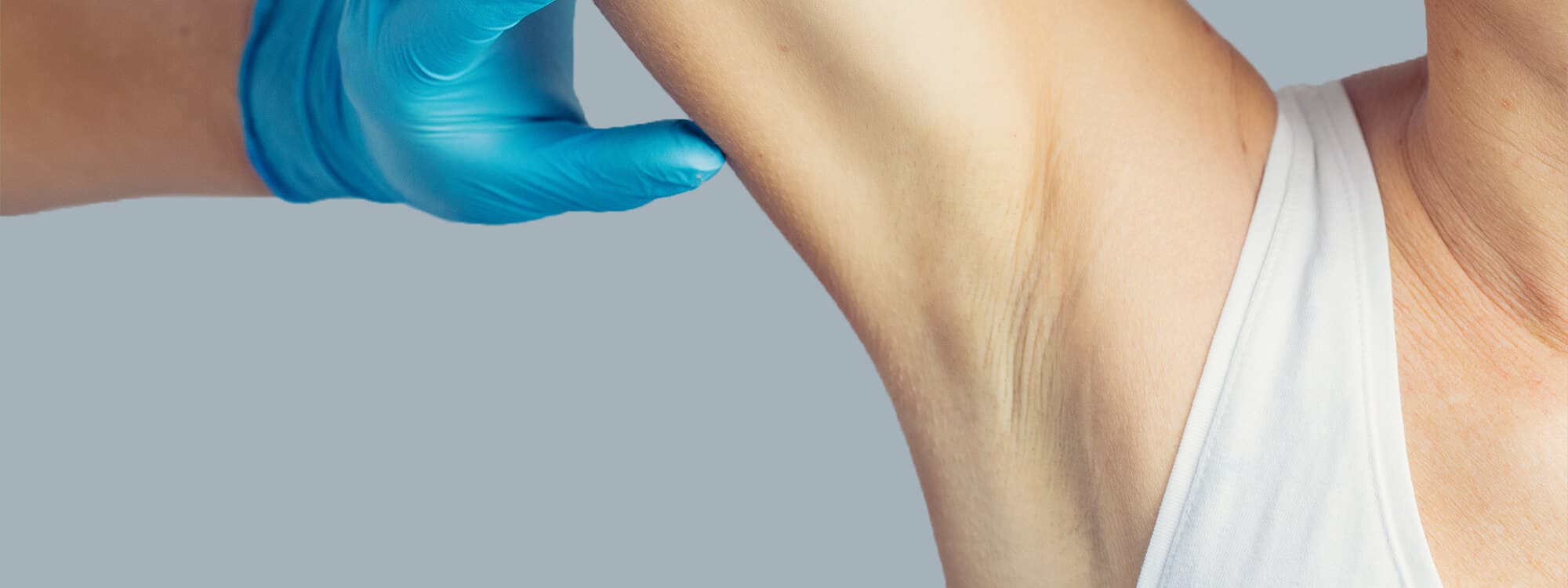 Sweating Treatment with Renewal Treatment