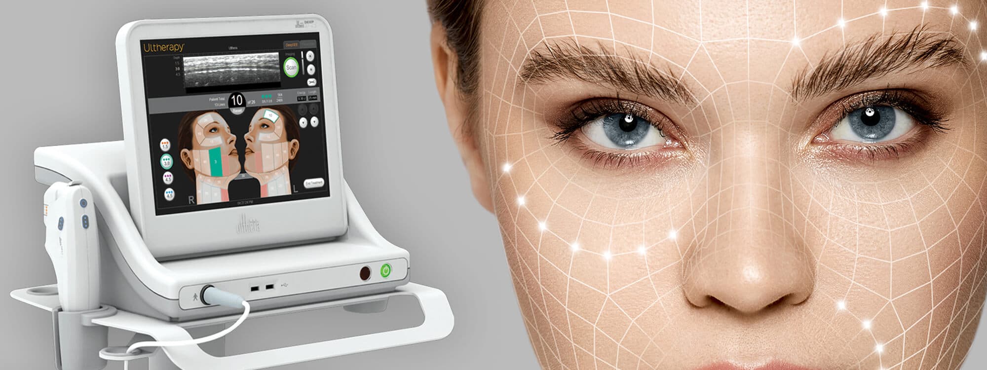 Ulthera(Ultherapy)