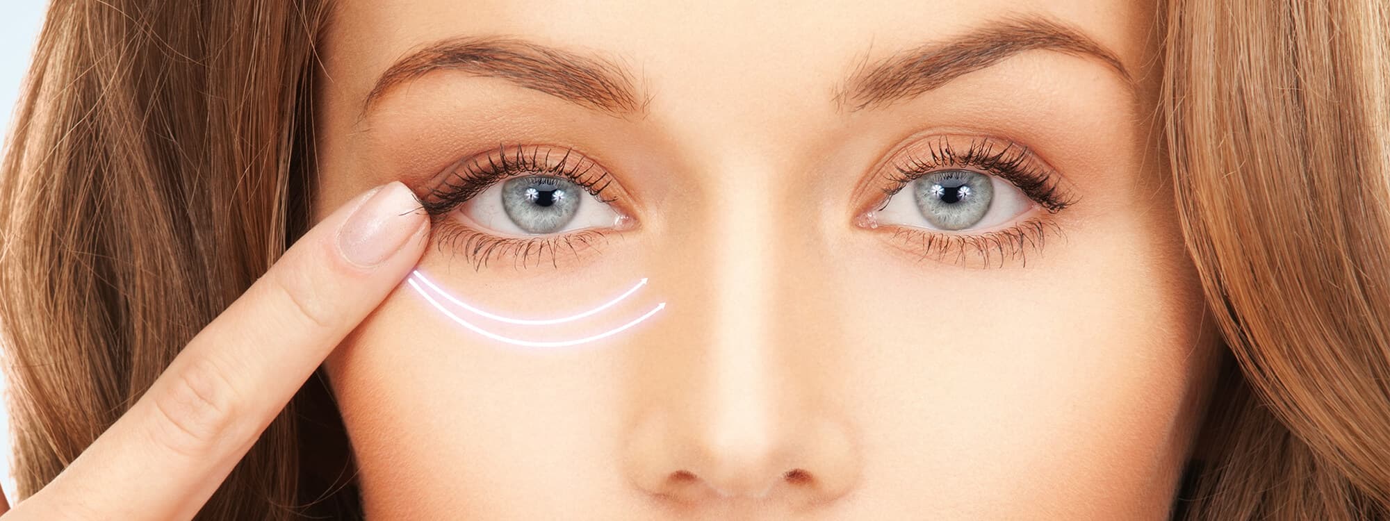 Under Eye Fillers