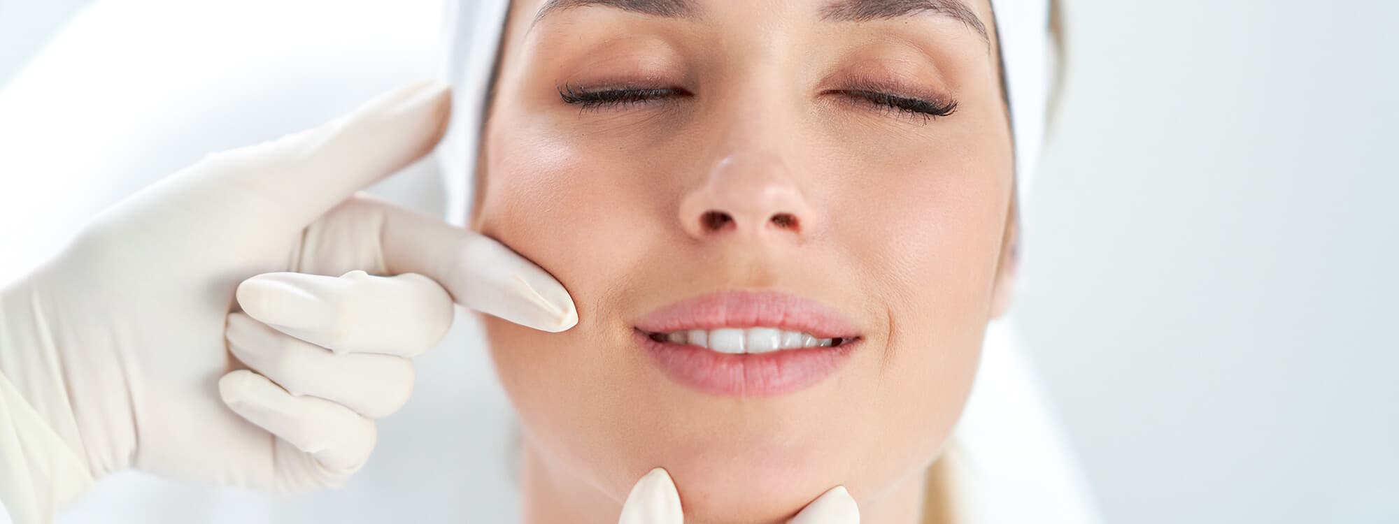 Cheekbone Fillers