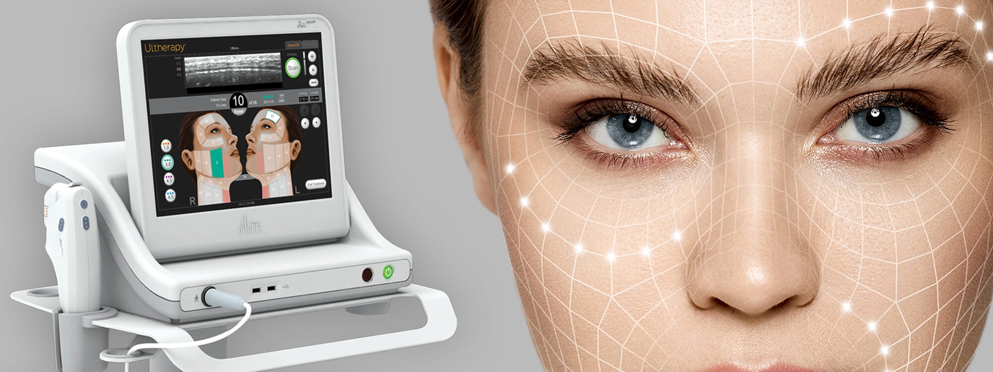 Ulthera (Ultherapy)