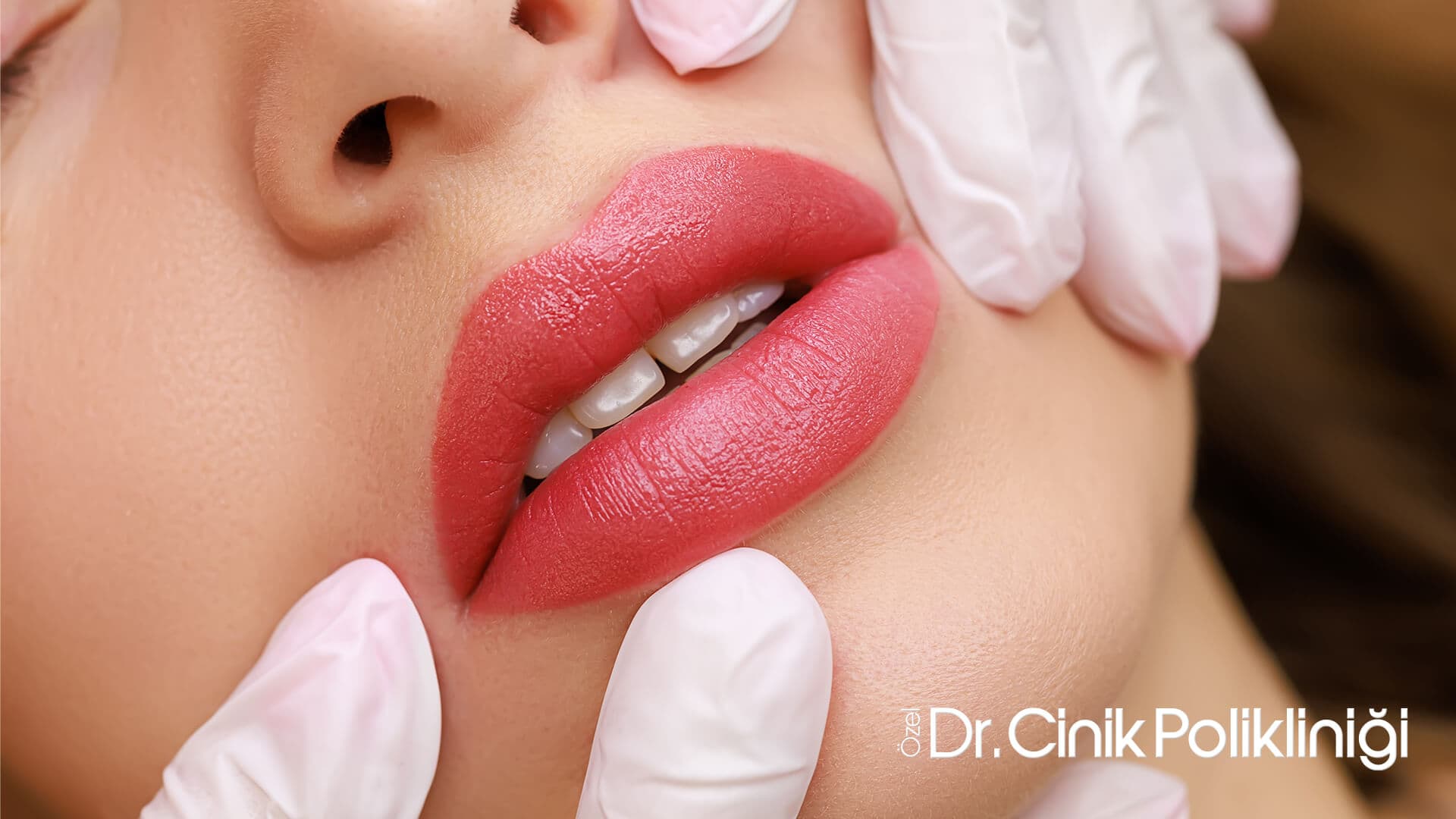 Things You Should Know About Lip Fillers